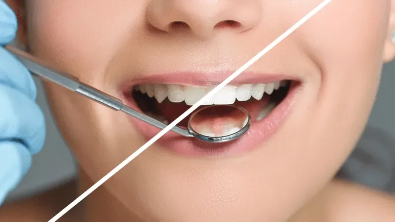 Professional teeth whitening in Trinity, FL